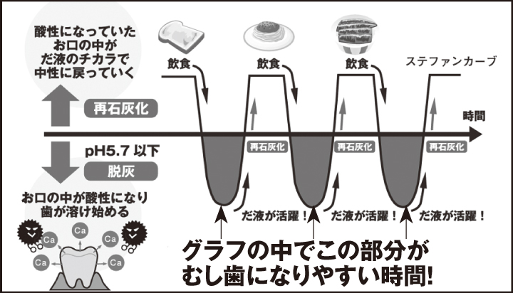 むし歯リスク