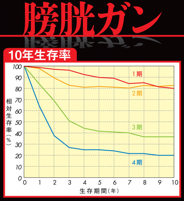 膀胱ガン