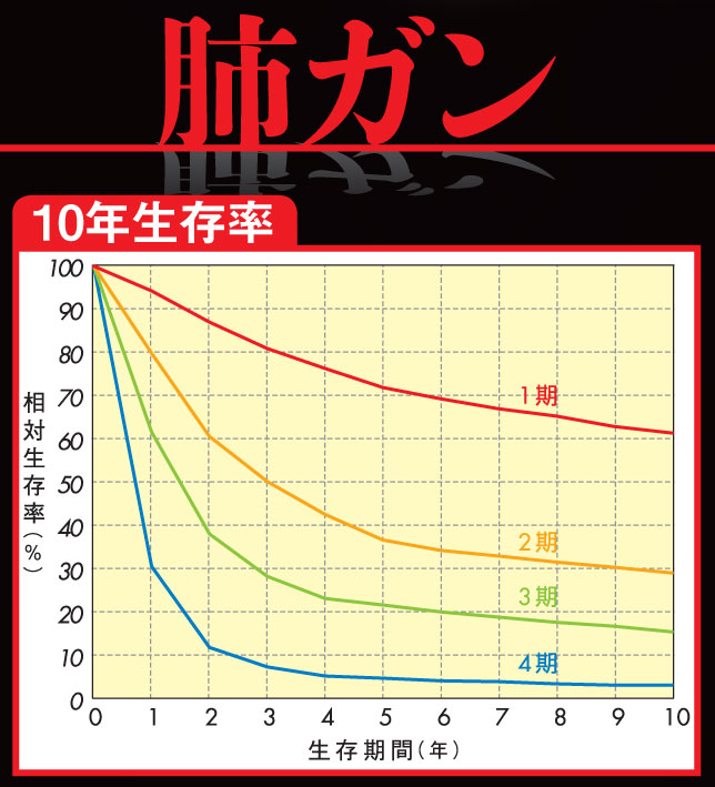 肺ガン