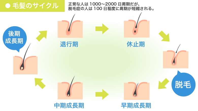 野球部、卓球部、剣道部経験者には薄毛が多い!?　知られざるAGAの真実に迫る