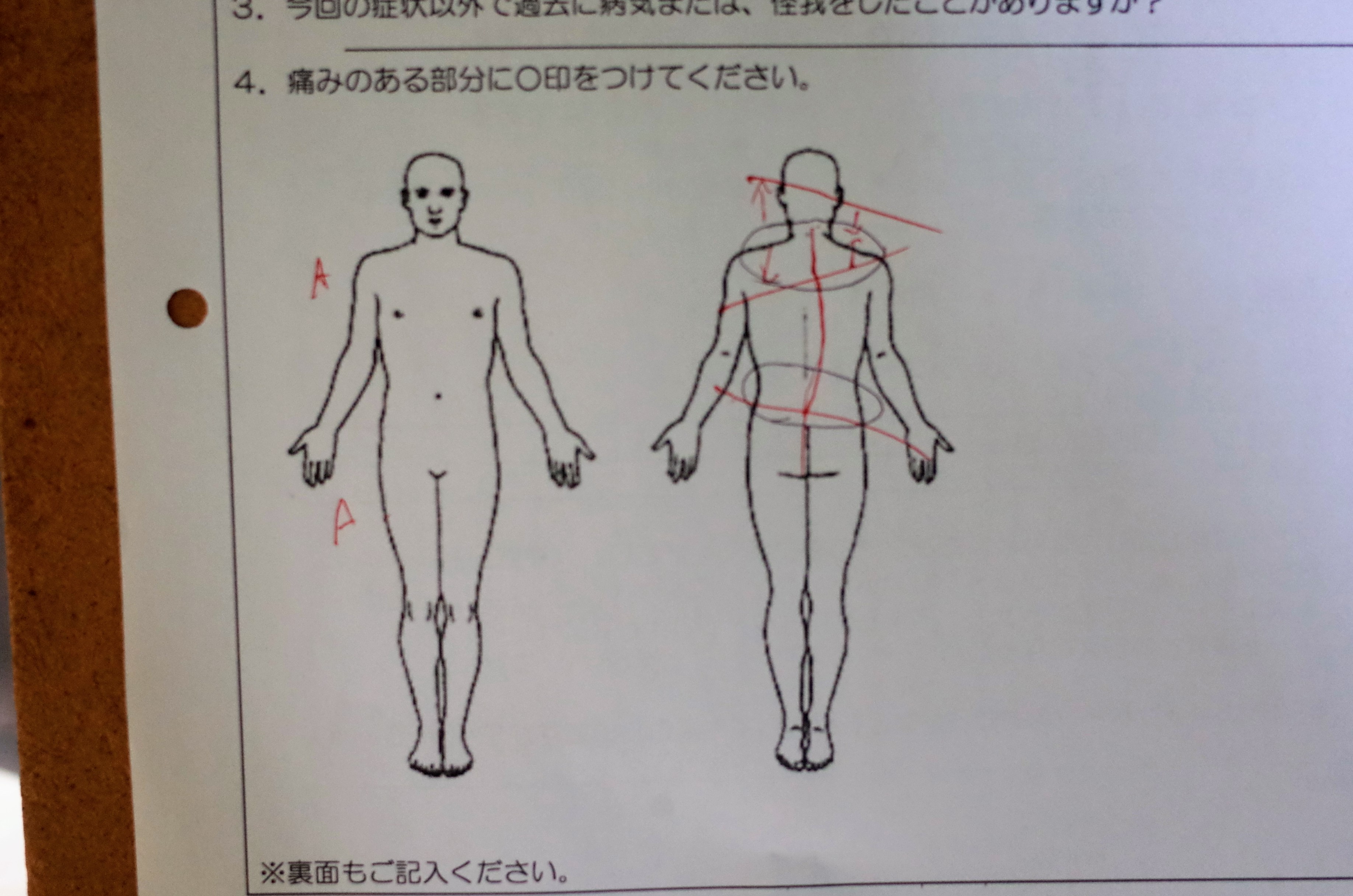 アゴの歪みとコリを取り除く“整顎”――オフィスワーカーには最強の整体技術!?