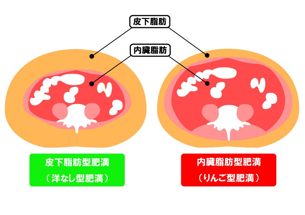 内臓脂肪と皮下脂肪