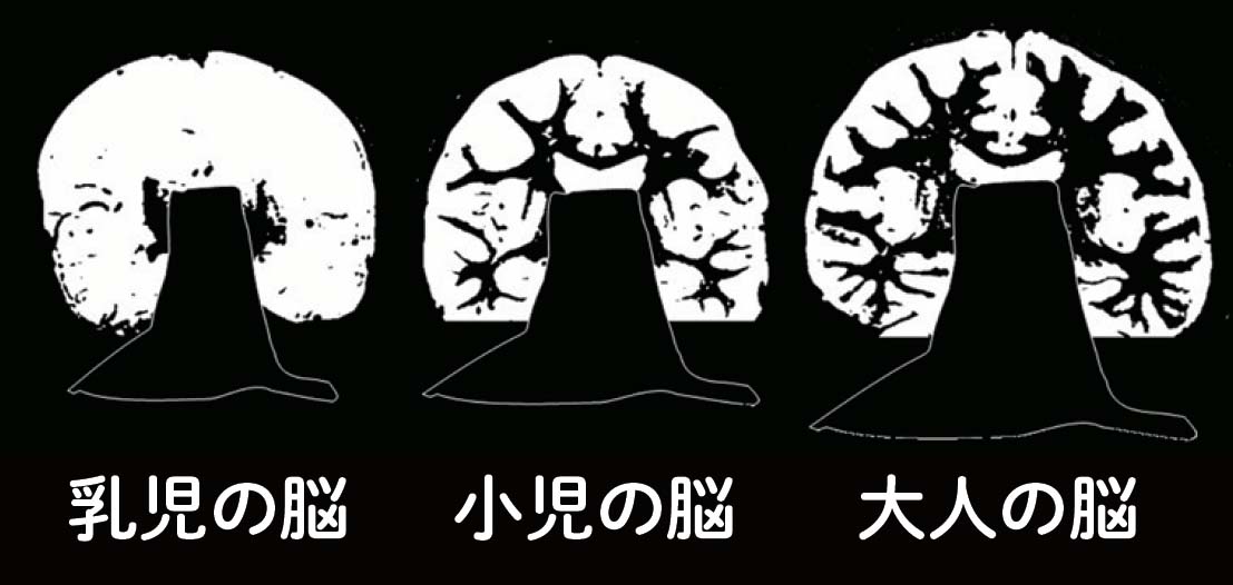 MRI画像で見た脳の成長の様子