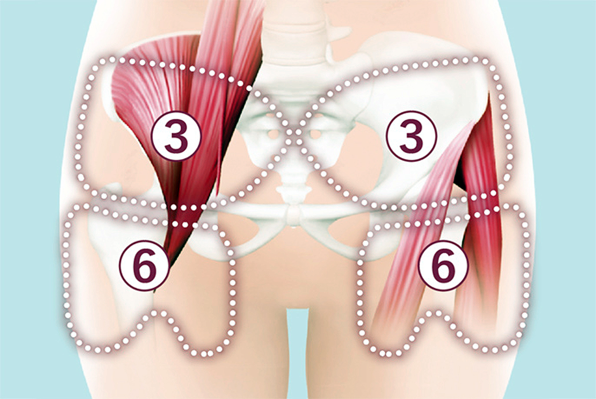 骨盤おしりリフレ