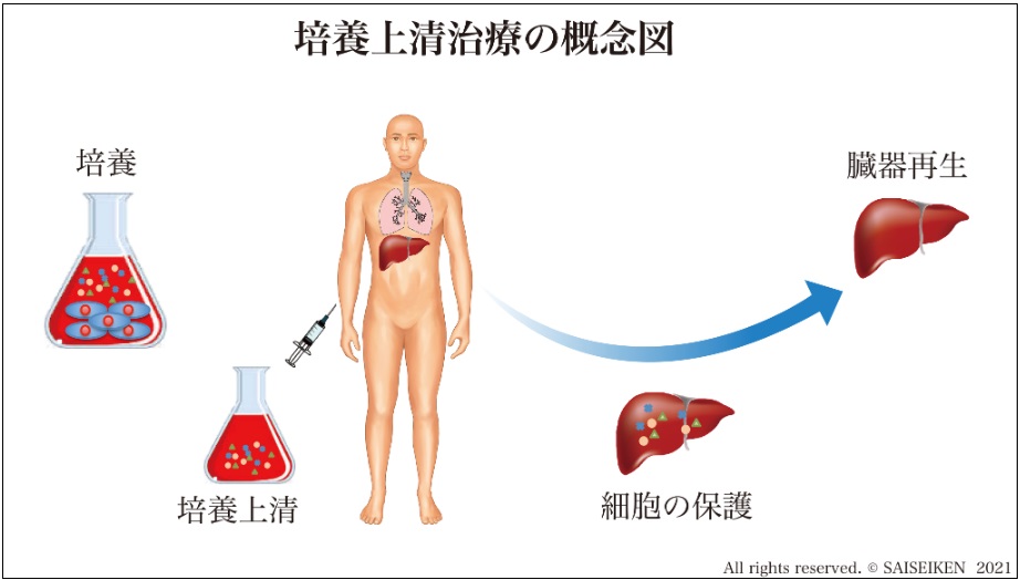 培養上清治療の概念図