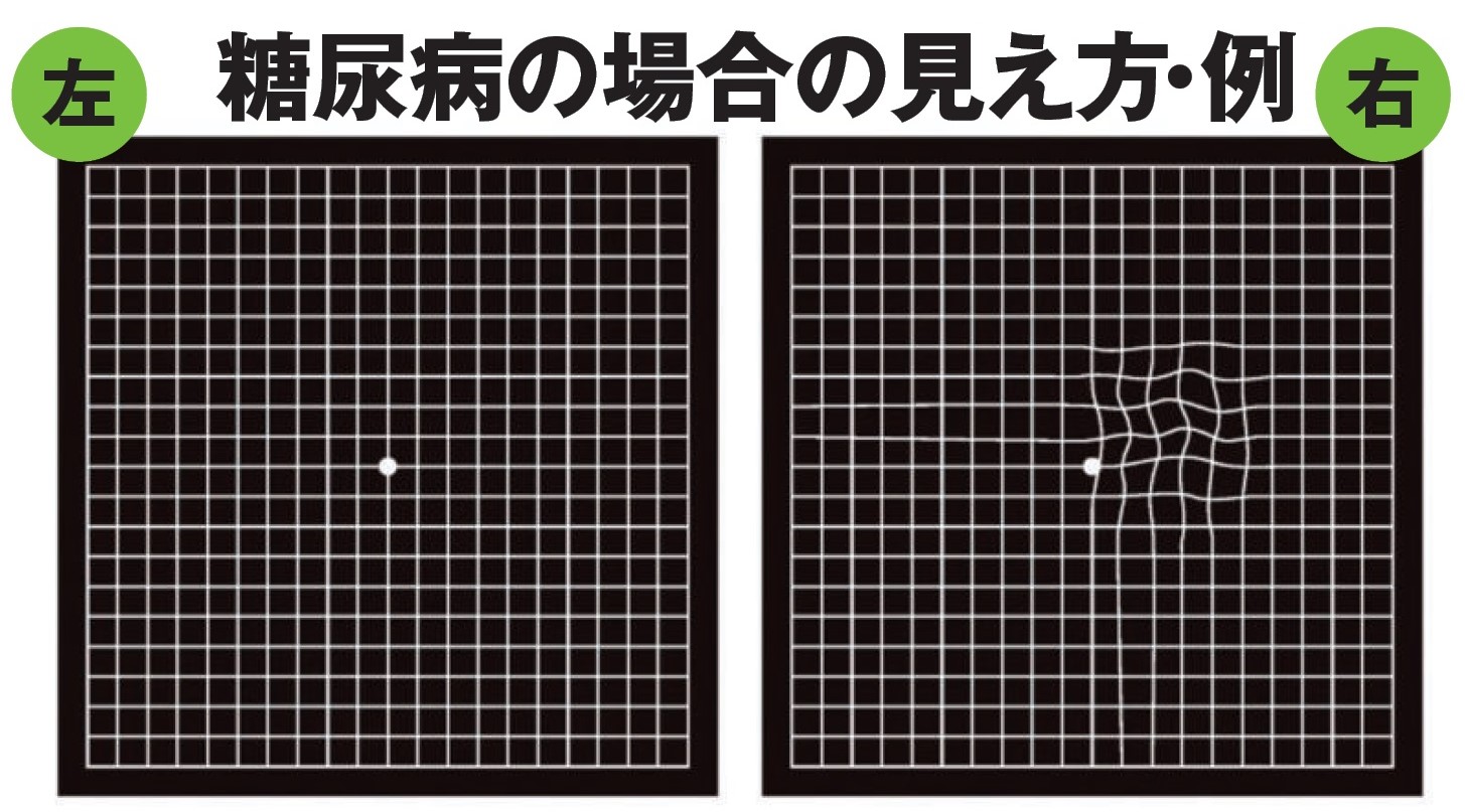 ［ヤバい病気］の前兆