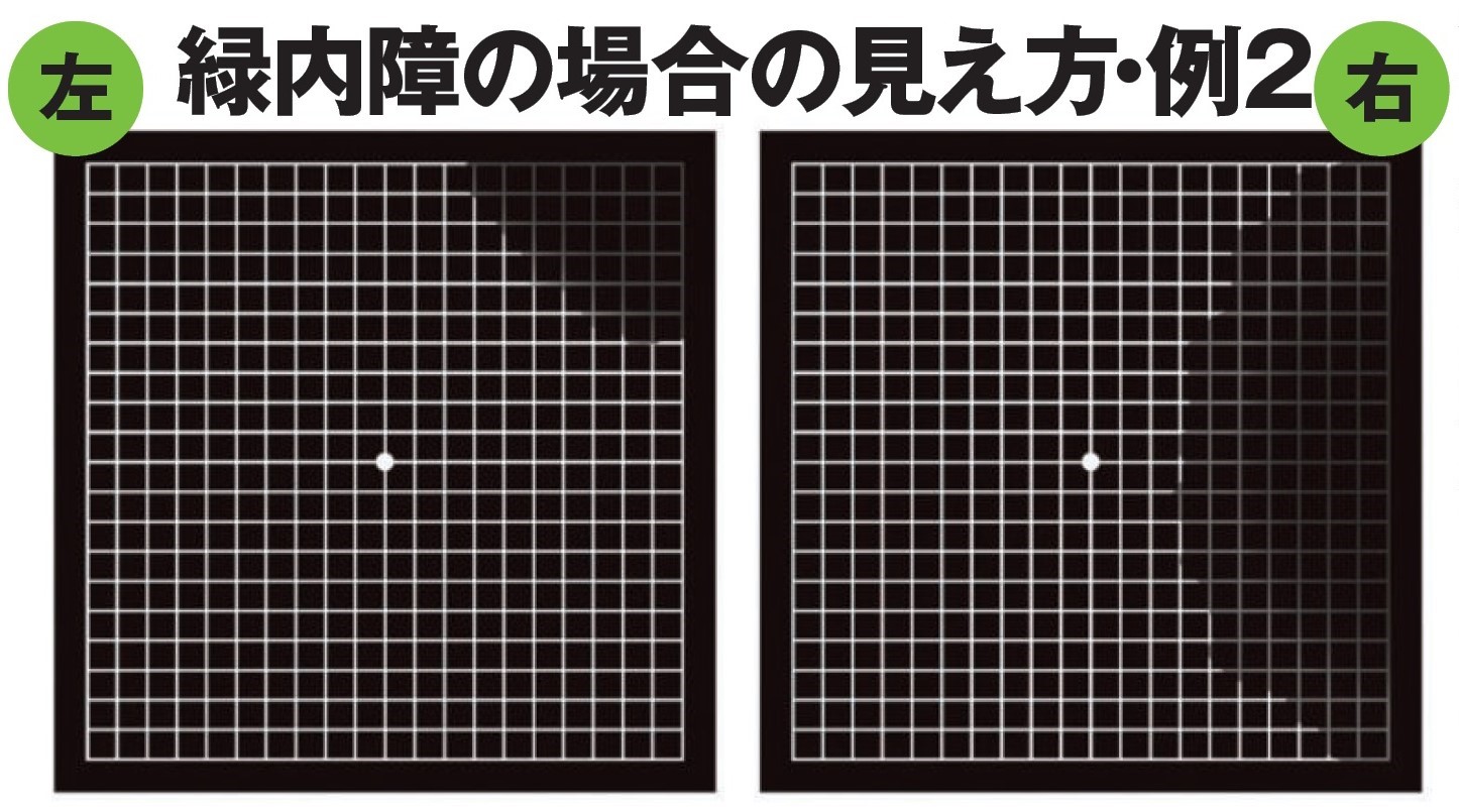 ［ヤバい病気］の前兆