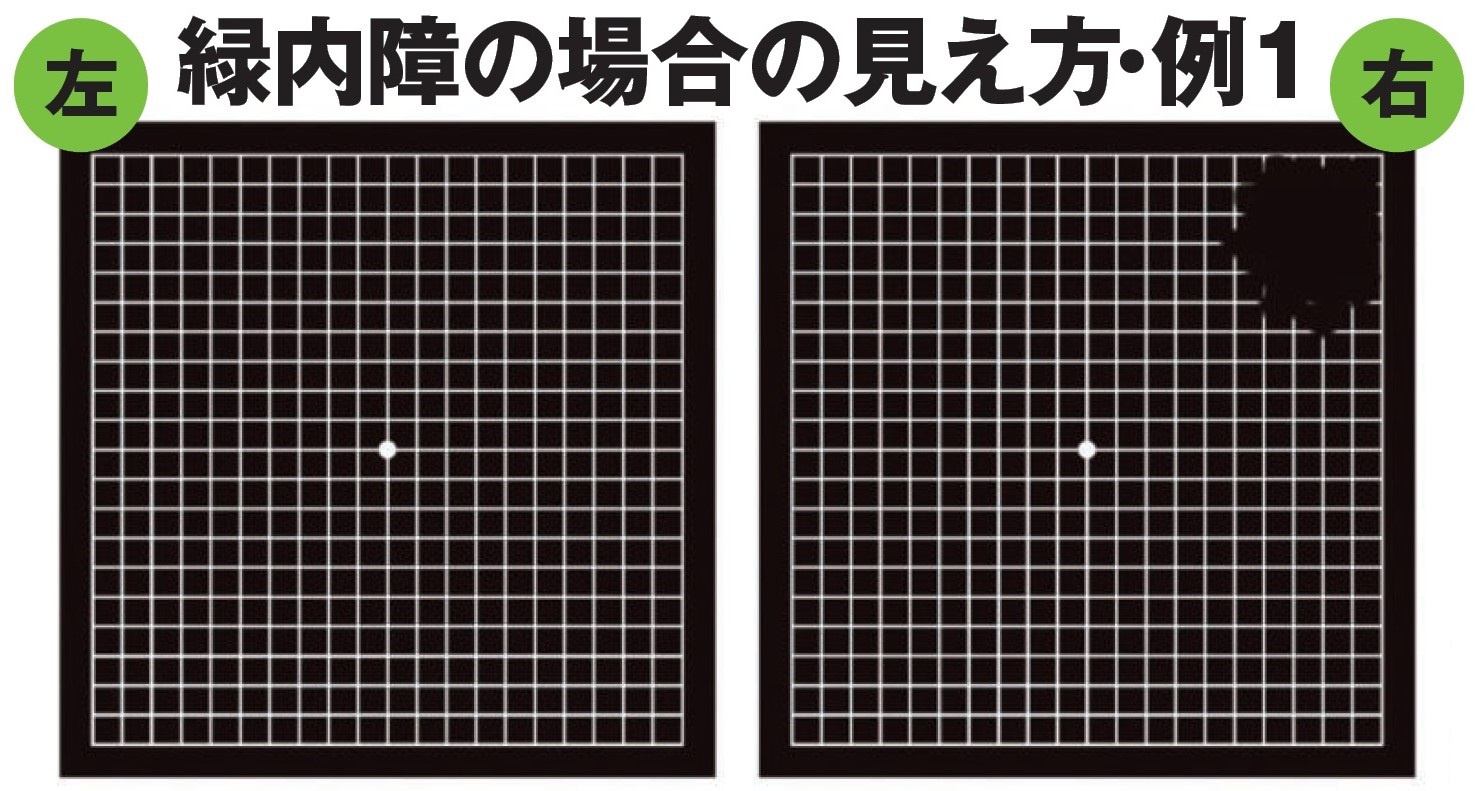 ［ヤバい病気］の前兆