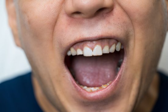 口を開いた男性