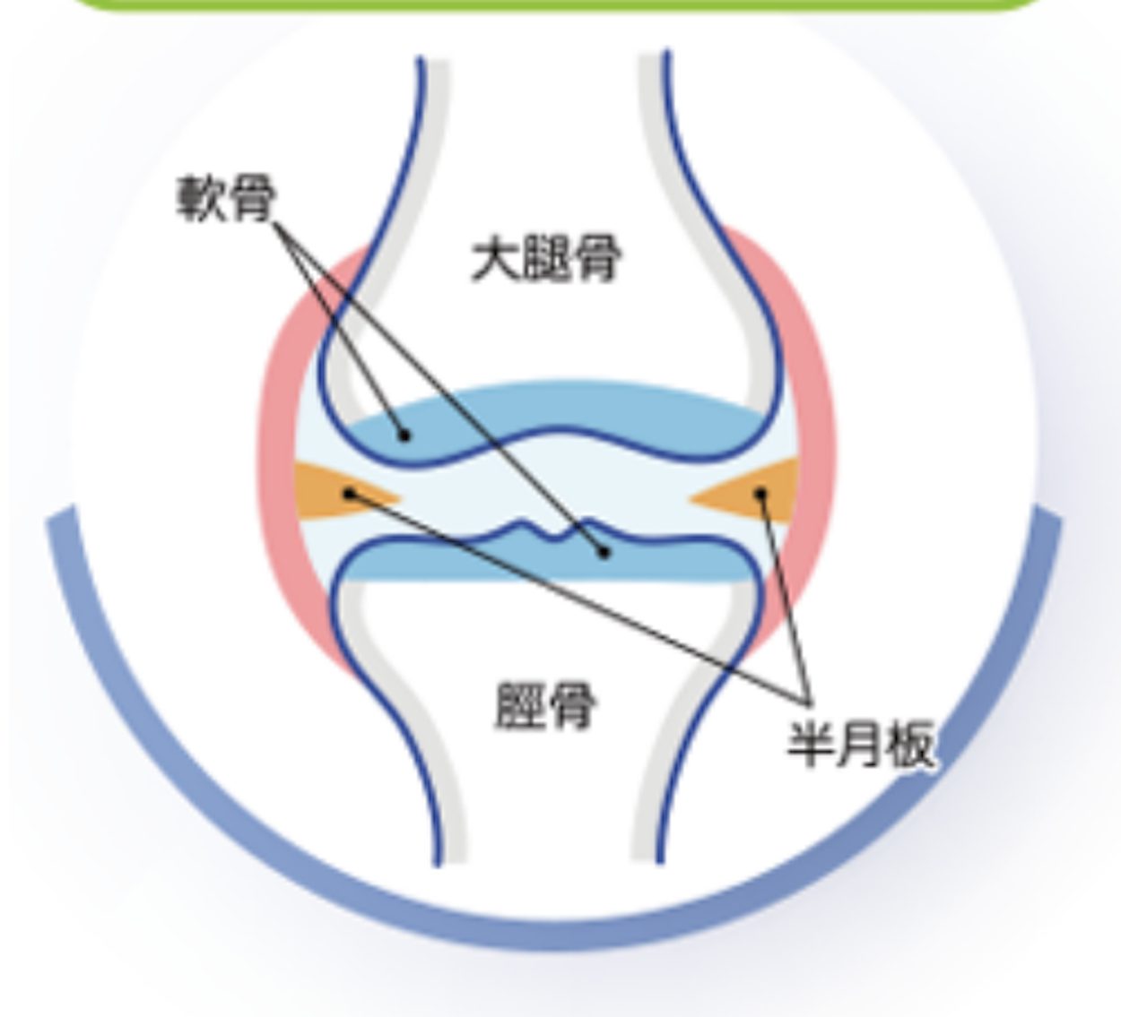 ［膝の痛み］を軽視してはいけない危険な理由